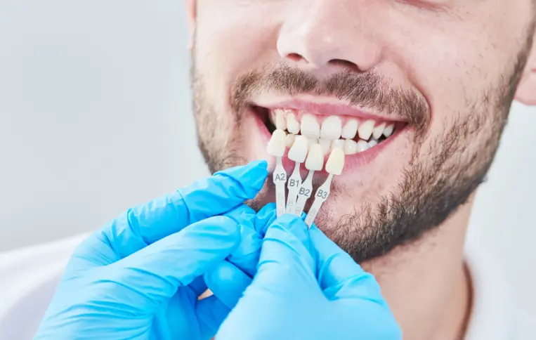 Alternative tooth implants