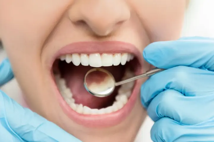 Dental Decay and Nutrition