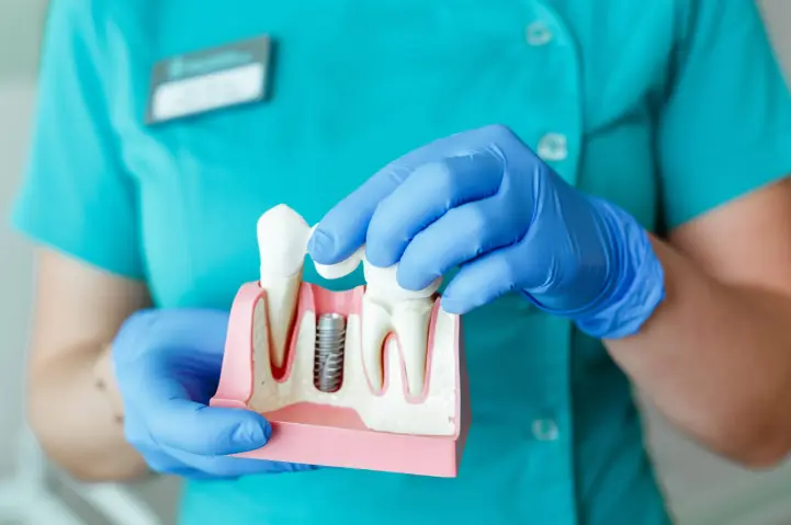 Post-implant dental care